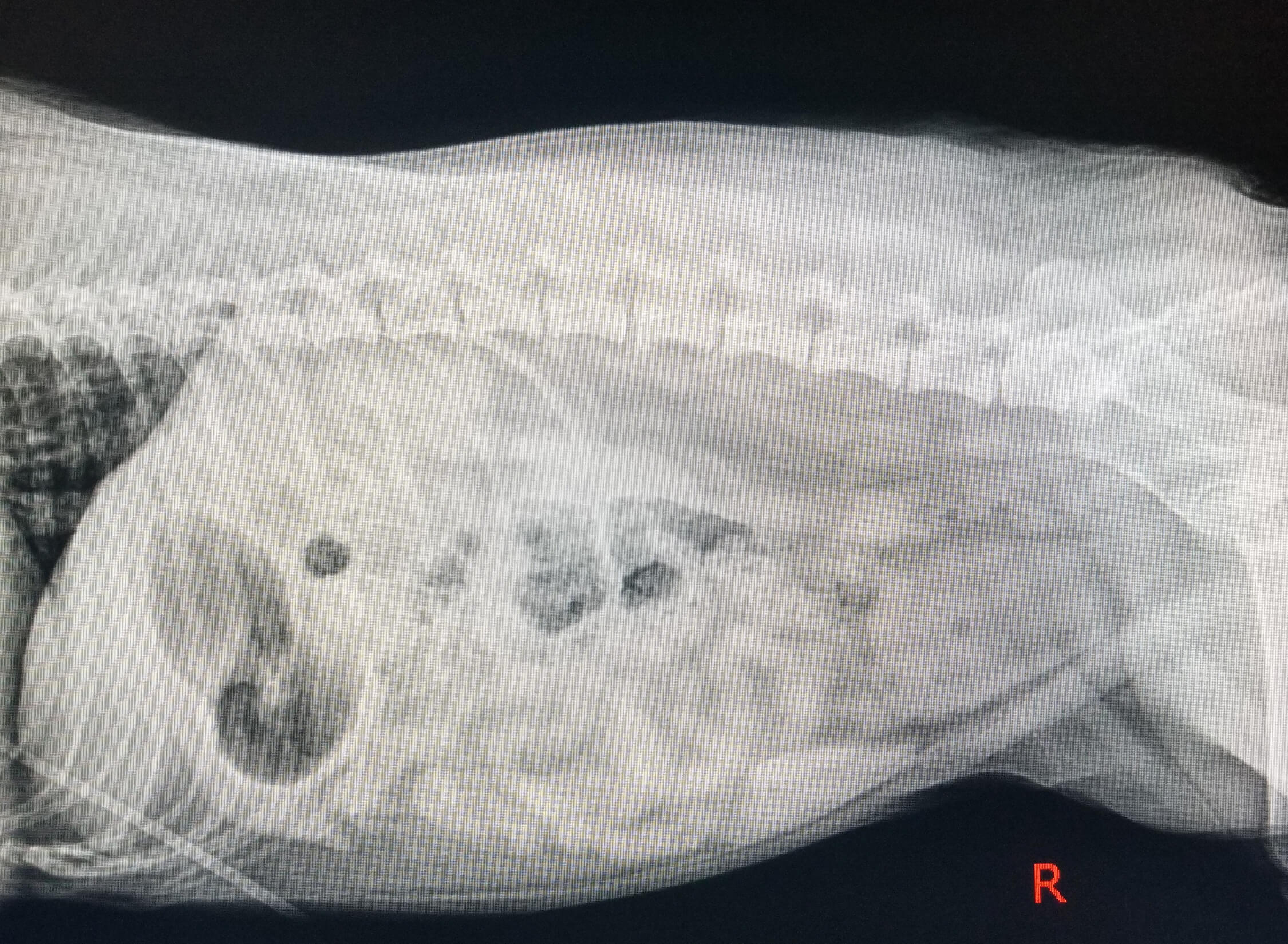 post-operative x-ray showing no remaining bladder stones